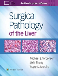 TORBENSON - SURGICAL PATH OF LIVER