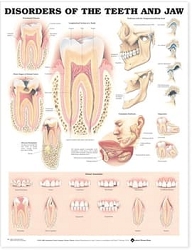 Disorders of the Teeth and Jaw Anatomical ...