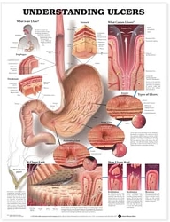 Understanding Carpal Tunnel Syndrome Anatomical Chart